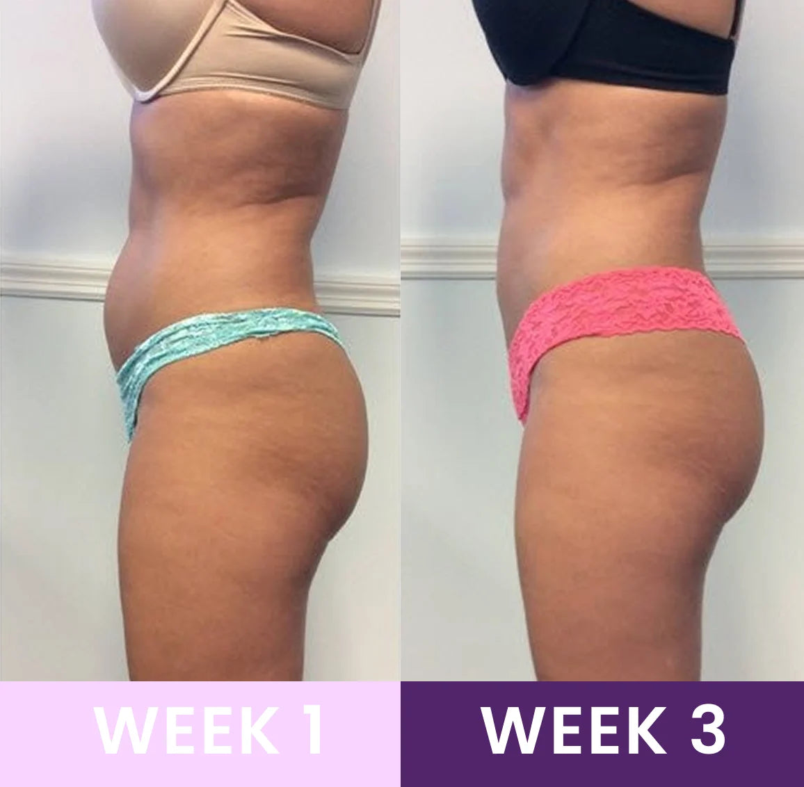 Faja Moldeadora FitShape - Cintura reductora